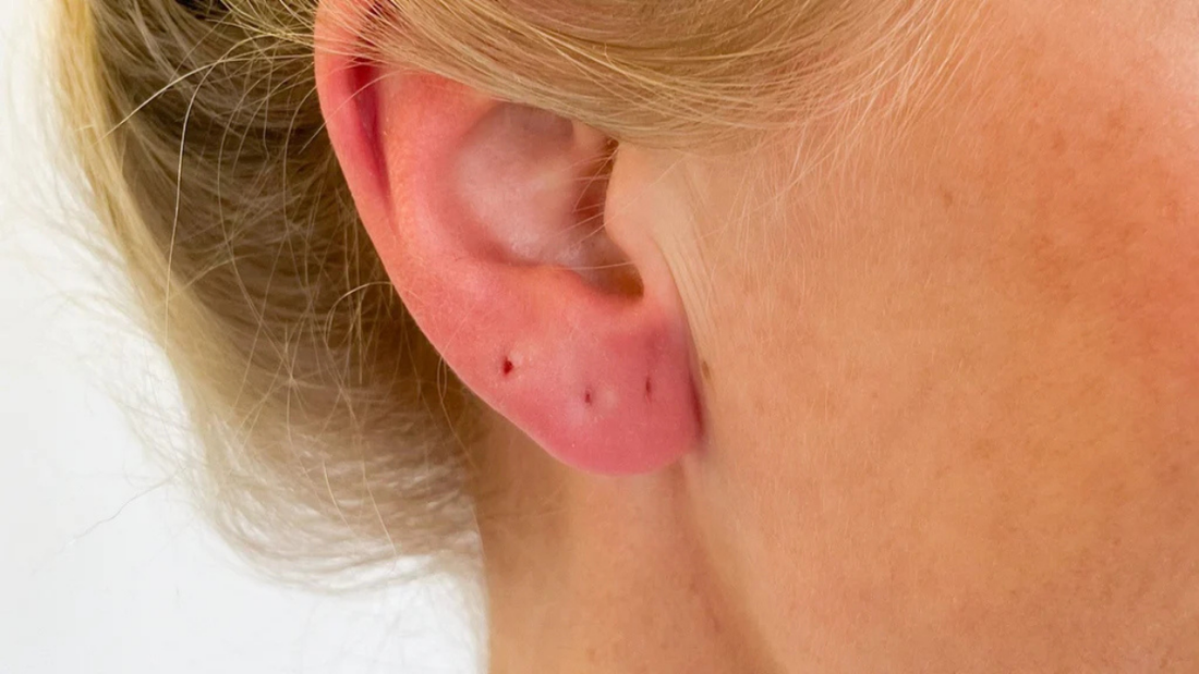 5 Golden Rules to Eliminate the Risk of Infection After Ear Piercing
