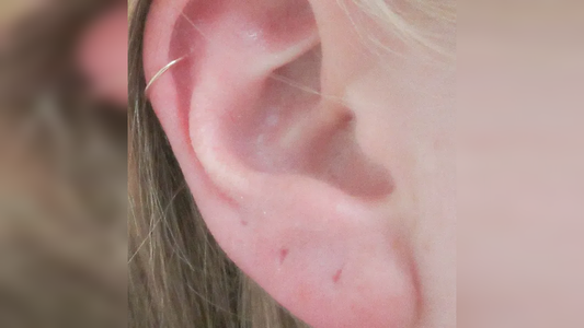 What Should Be Done to Prevent an Ear Piercing Hole from Closing?