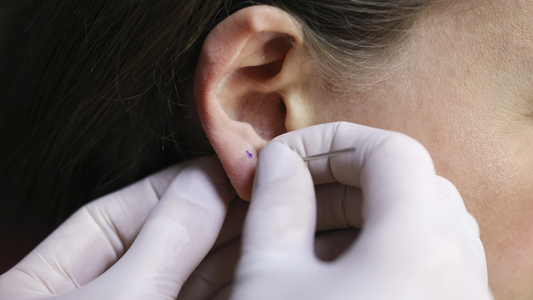 How Does the Ear Piercing Process Progress Step by Step?